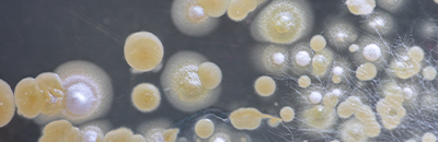 yeast-fermentation-stage-mobile.jpg